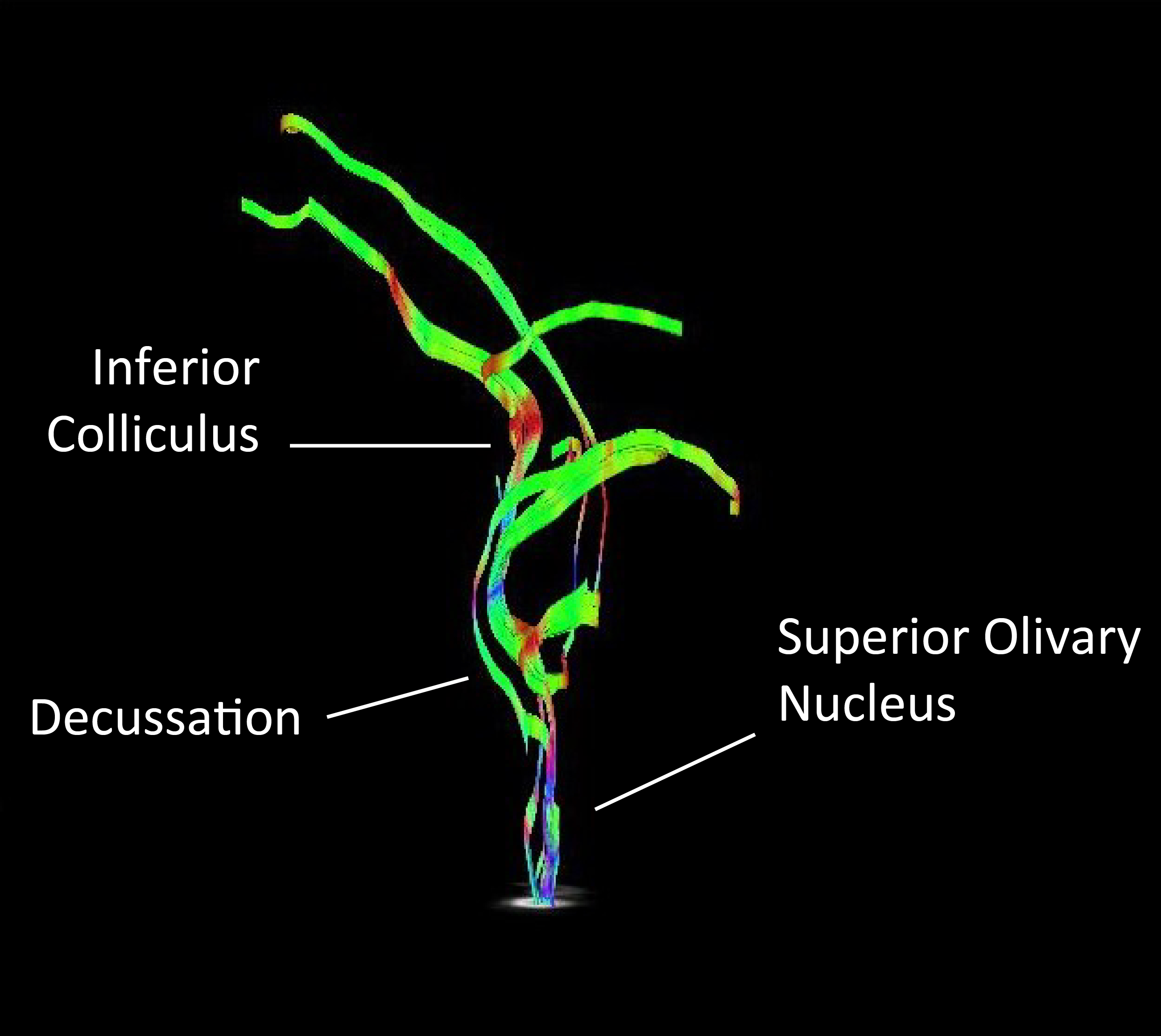 Tractography